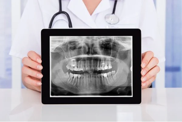 Low Radiation X-Ray